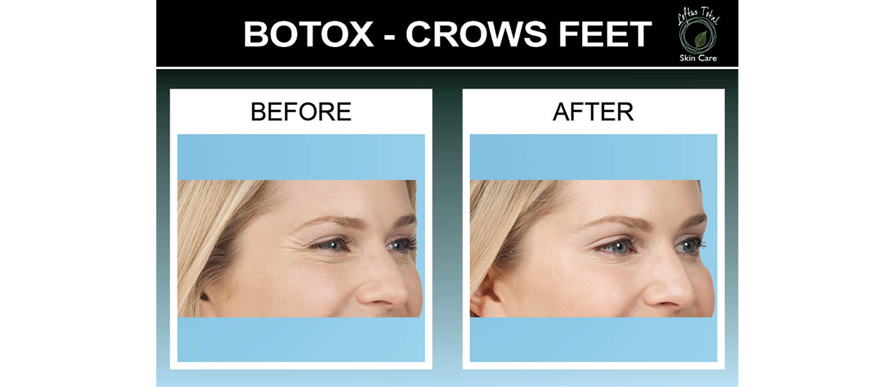 Loftus Plastic Surgery Center Fort Wright, KY 8594265000 City to